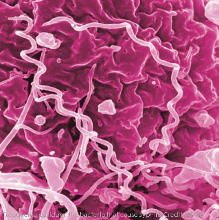 Treponema pallidum, the bacteria that cause syphilis.