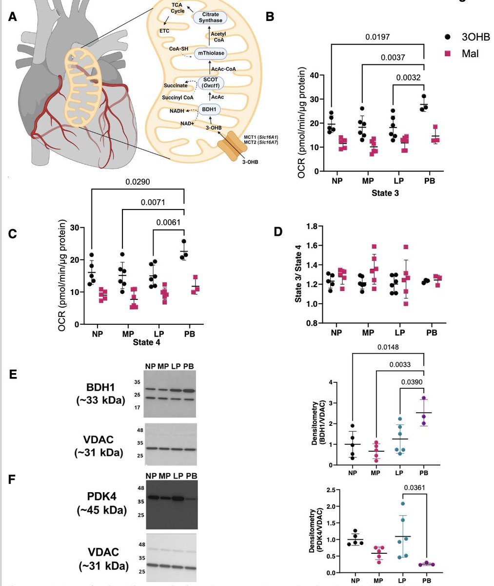 #ArticlesInPress: Cardiac Mitochondrial #Metabolism During Pregnancy and the #Postpartum Period
Emily B. Schulman-Geltzer et al.
ow.ly/P5Z750RjT24
@DrHelenECollin1 @emibrockn23 @CardioMetaboSci
#physiologicalhypertrophy #femalecardiacbiology