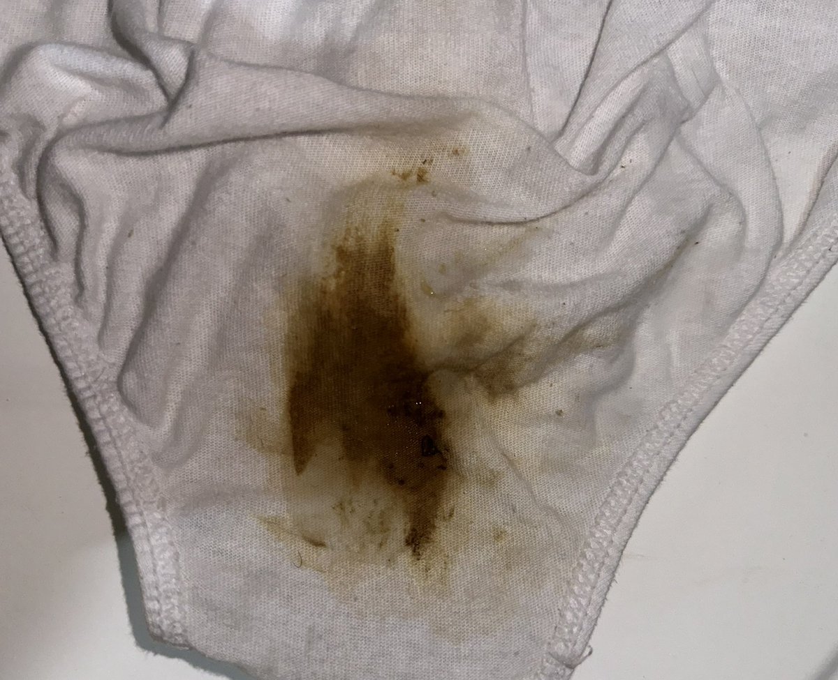 Scateirohard's tweet image. I was on the street and I couldn't hold it until I got home 💩

Eu estava na rua e não aguentei segurar até chegar em casa 💩
.
.
.

#scat #pig #shit #scatboy #scateater #gaypig #scatfeeding #scatbook #malescat #toiletfag #scatsex #toiletpig #manscat