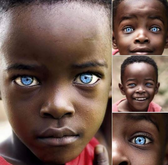 They aren’t photoshopped. The natural sapphire eyes of Kabila An Ugandan 🇺🇬 photographer named Jjumba Martin met him on the streets of Uganda and took pictures of him, the world cannot seem to get enough of him and his unique sapphire eyes. Your comments on this ...