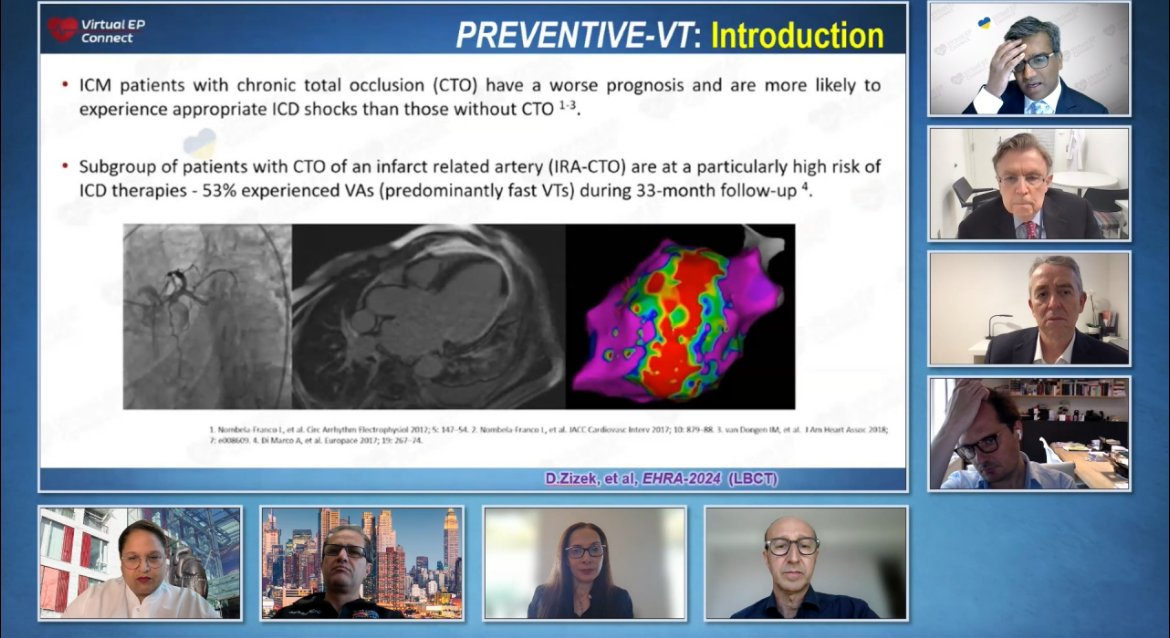 #EPeeps Happening Now. @connectEP Session LXX. ACC.24/EHRA.24 Scientific Sessions Highlights featuring @VivekReddyMD @SanaAlkhatib9 @SergeBoveda @tomdepotter @LuigiDiBiaseMD @joselmerino Francis Marchlinski @AriSultanEP Join @ virtualepconnect.com/event/live