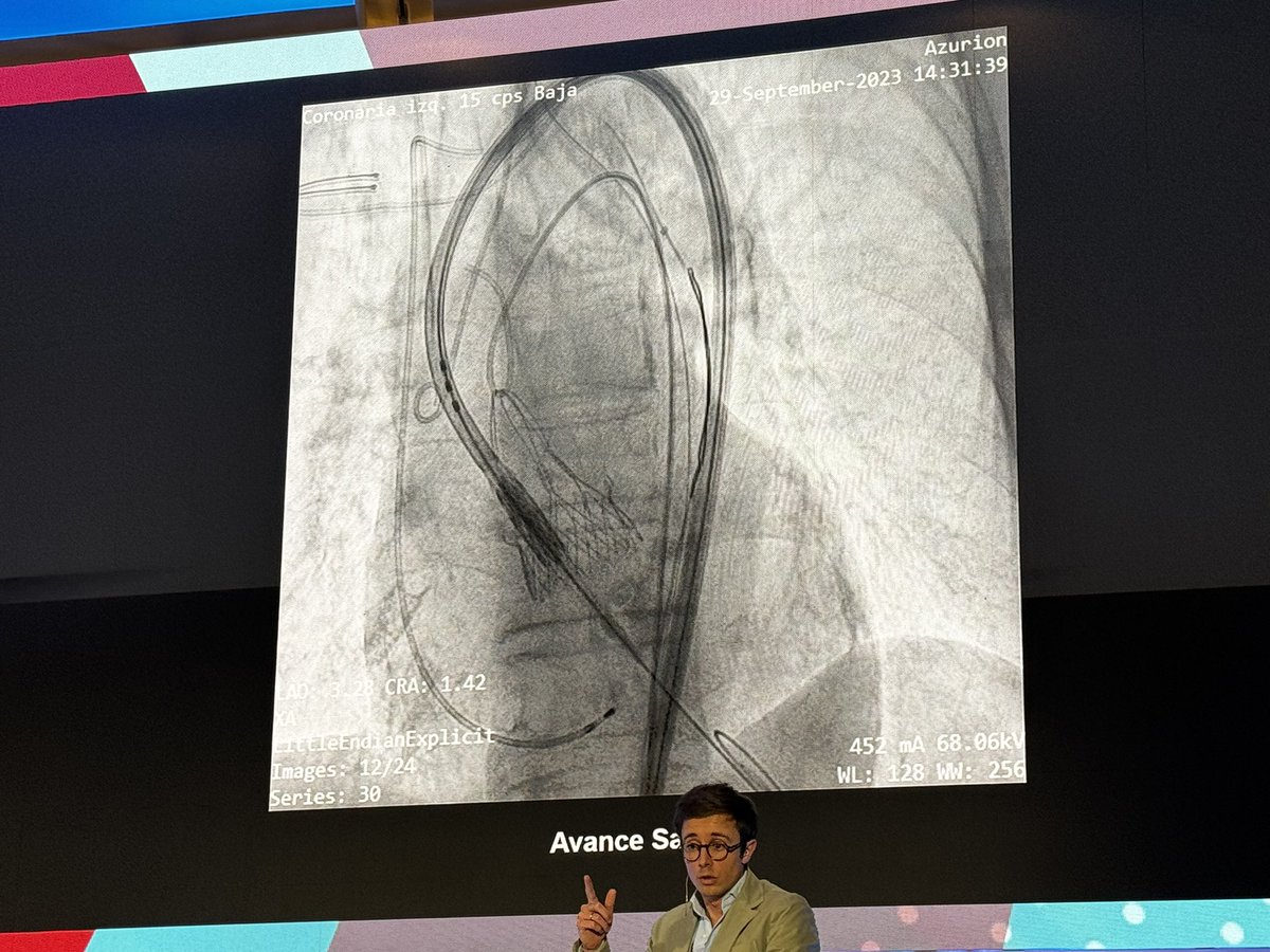 belcid7's tweet photo. El Curso de Complicaciones es uno de los imprescindibles para cualquier cardiólogo intervencionista, una cura de aprendizaje…y humildad. 
Enhorabuena a los compañeros de Bellvitge por el éxito de esta edición y gracias por la iniciativa y el trabajazo!  @shci_sec @PCRonline https://t.co/GjhlcyQ5Oo