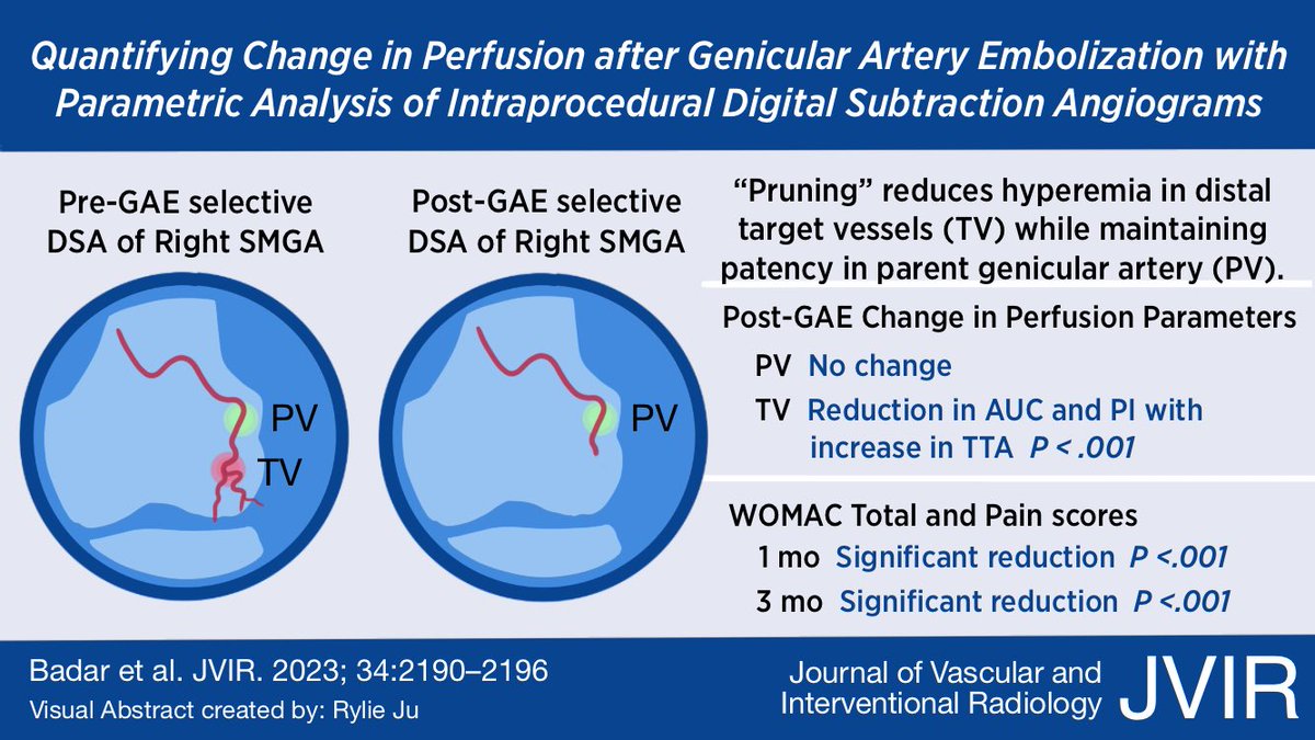 New virtual abstract by medical student Rylie Ju on quantification of a perfusion changes after genicular artery embolization. #IRad #embolization