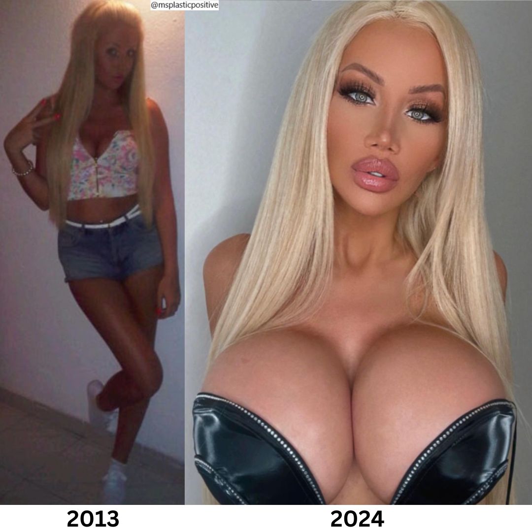 IG: missjessicawilde #plasticsurgery #cosmeticsurgery #bimbogirl #bimbobarbie #bimbo #bimbogoddess #BreastAugmentation #bigboobs #plasticlife #plasticdoll #plasticmakesperfect