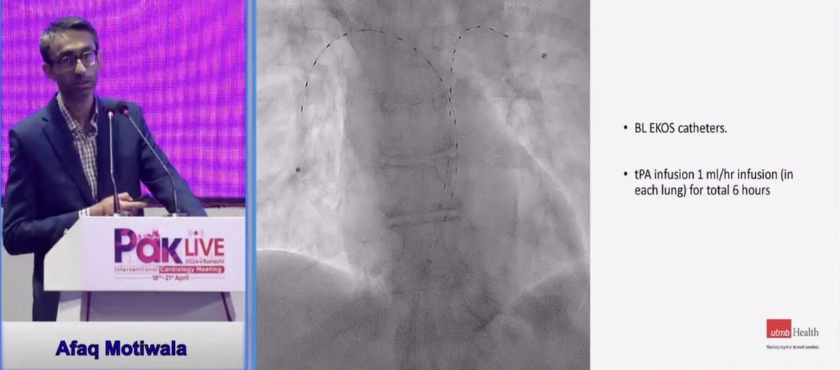 Our own Dr Afaq Motiwala giving an authoritative lecture on PERT & interventional treatments for PE at the PAK international meeting in Karachi @utmbcardiology @ACCinTouch @UTMBInternalMed
