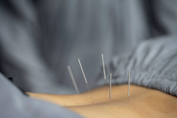 BohnChiro's tweet photo. Unlock your body's natural healing potential with Acupuncture. Our skilled practitioners combine ancient wisdom with modern expertise to address a wide range of conditions. https://t.co/kTisQDyO8Q