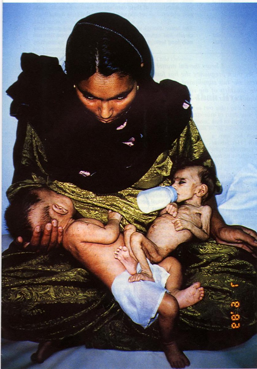 Let us remember why we have the WHO Code. Same applies in high income countries. <a href="/MurrayWatt/">Senator Murray Watt</a> <a href="/D_LittleproudMP/">David Littleproud MP</a> this is often the result of your grants, life and death <a href="/AlboMP/">Anthony Albanese</a> no exaggeration your Government grant has these consequences Image <a href="/UNICEF/">UNICEF</a>