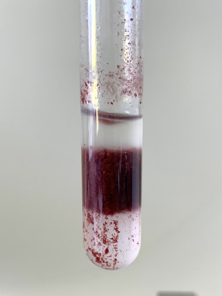 Theresa_May_PhD's tweet photo. The wonders of chemistry &amp; biology, extraction of fatty acids from their blood cell components 🙌🏼💉🩸⚗️ Here’s the before &amp; after centrifugation of fatty acids extracted from their plasma &amp; red blood cells components.
#theindicostudy #fattyacids #dietaryfats #phdresearch https://t.co/gkE59NHkKF