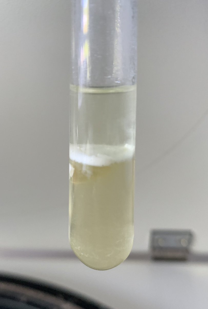 Theresa_May_PhD's tweet photo. The wonders of chemistry &amp; biology, extraction of fatty acids from their blood cell components 🙌🏼💉🩸⚗️ Here’s the before &amp; after centrifugation of fatty acids extracted from their plasma &amp; red blood cells components.
#theindicostudy #fattyacids #dietaryfats #phdresearch https://t.co/gkE59NHkKF