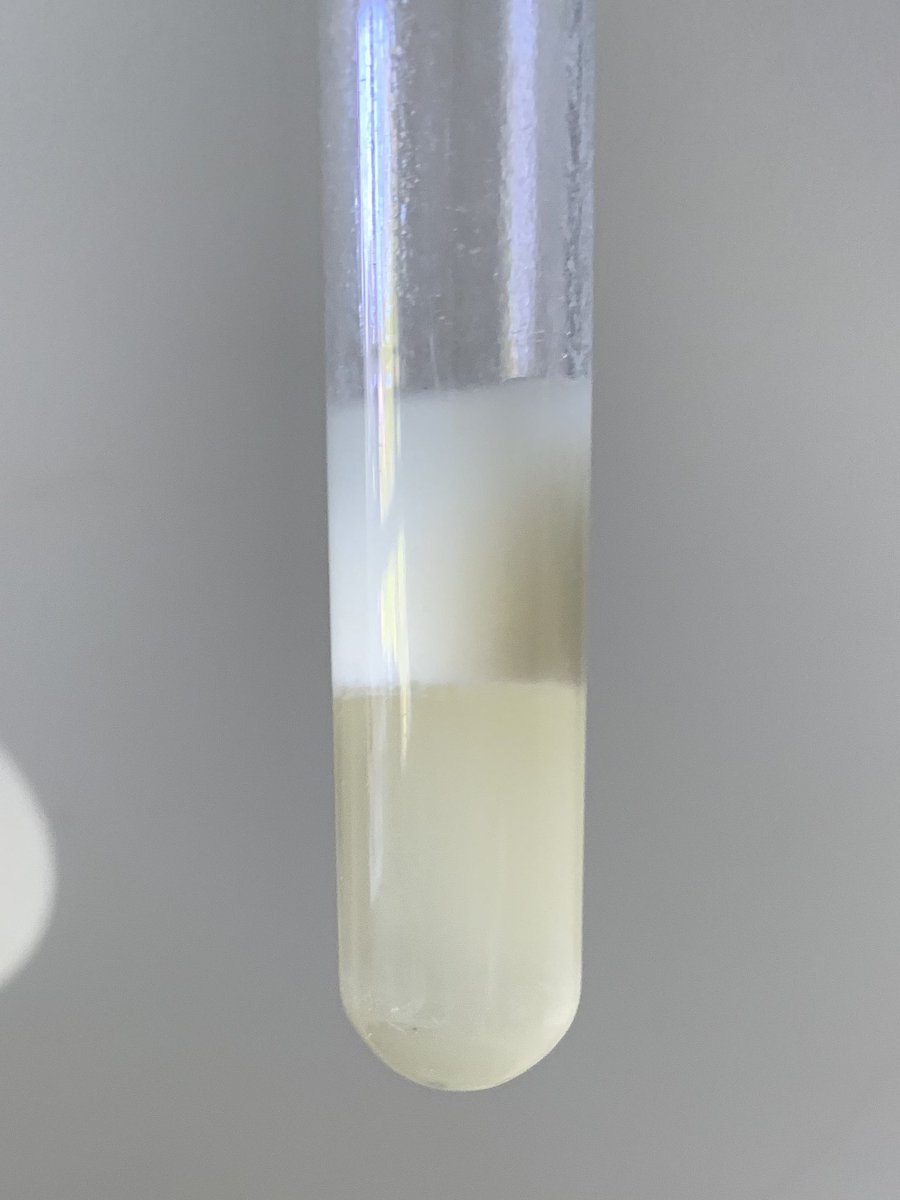 Theresa_May_PhD's tweet photo. The wonders of chemistry &amp; biology, extraction of fatty acids from their blood cell components 🙌🏼💉🩸⚗️ Here’s the before &amp; after centrifugation of fatty acids extracted from their plasma &amp; red blood cells components.
#theindicostudy #fattyacids #dietaryfats #phdresearch https://t.co/gkE59NHkKF