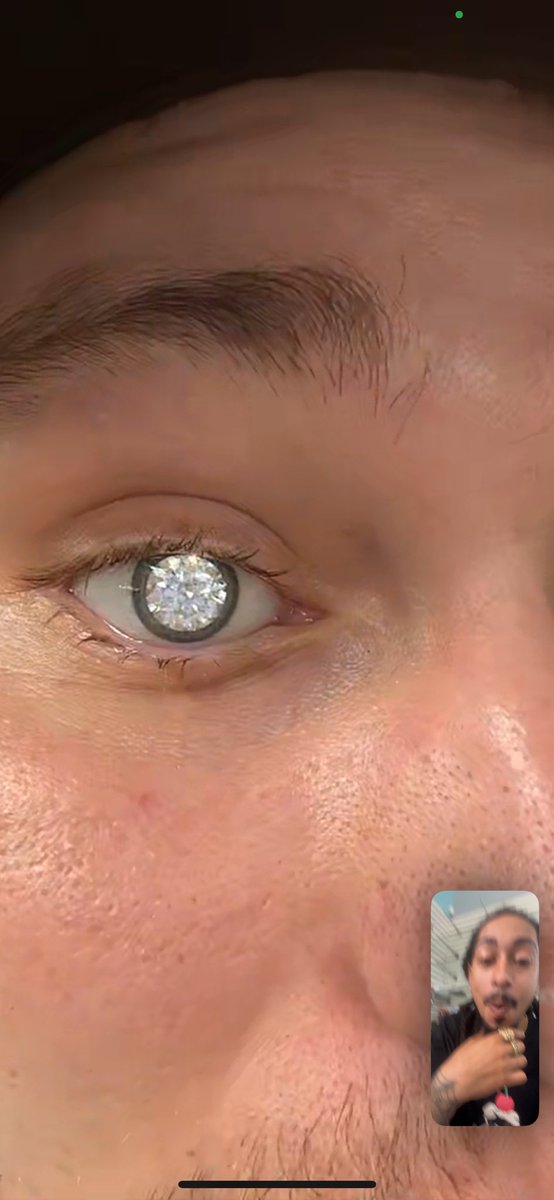 HBMWildz's tweet image. LMAO so I got a homeboy who’s a diamond setter in Alabama and he was losing his eye so we talked about him putting a diamond in his eye and bruh LOOK at this 😭🤣 diamond boys frr 💎 The last pic is what it looked like before