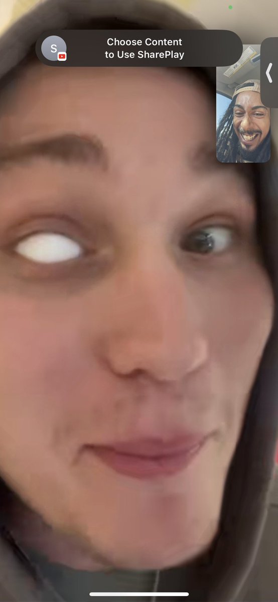 HBMWildz's tweet image. LMAO so I got a homeboy who’s a diamond setter in Alabama and he was losing his eye so we talked about him putting a diamond in his eye and bruh LOOK at this 😭🤣 diamond boys frr 💎 The last pic is what it looked like before