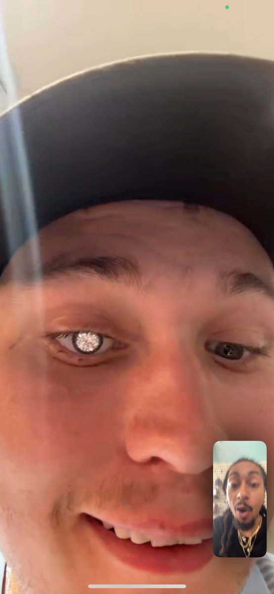 HBMWildz's tweet image. LMAO so I got a homeboy who’s a diamond setter in Alabama and he was losing his eye so we talked about him putting a diamond in his eye and bruh LOOK at this 😭🤣 diamond boys frr 💎 The last pic is what it looked like before