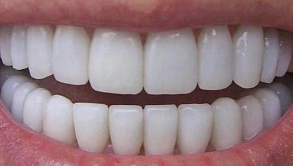itsD3lay's tweet photo. mi fantasía sexual es tener los dientes así https://t.co/844HxVKMT5