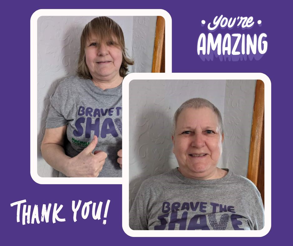 Alison Willetts has successfully raised £280.00 for the Derby and Burton Hospitals Charity through a courageous act of shaving her head in honour of her late sister, Sandra. Read Alison's story here bit.ly/49INT1l