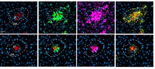 Update on translational efforts to modulate microglia in the treatment of Alzheimer's disease and Parkinson's disease from the 2024 ADPD meeting and @alzforum  alzforum.org/news/conferenc…