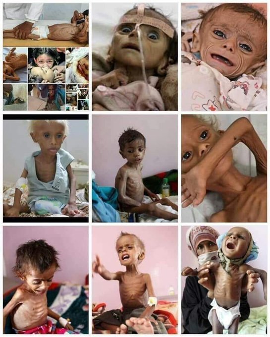 #Yemen🇾🇪
#StandUpForYemen
#StopStarvingYemeniChildren
#SopAllWars
#HelpSyria 
#FreePalestine🇵🇸
#EndIsraelsGenocide