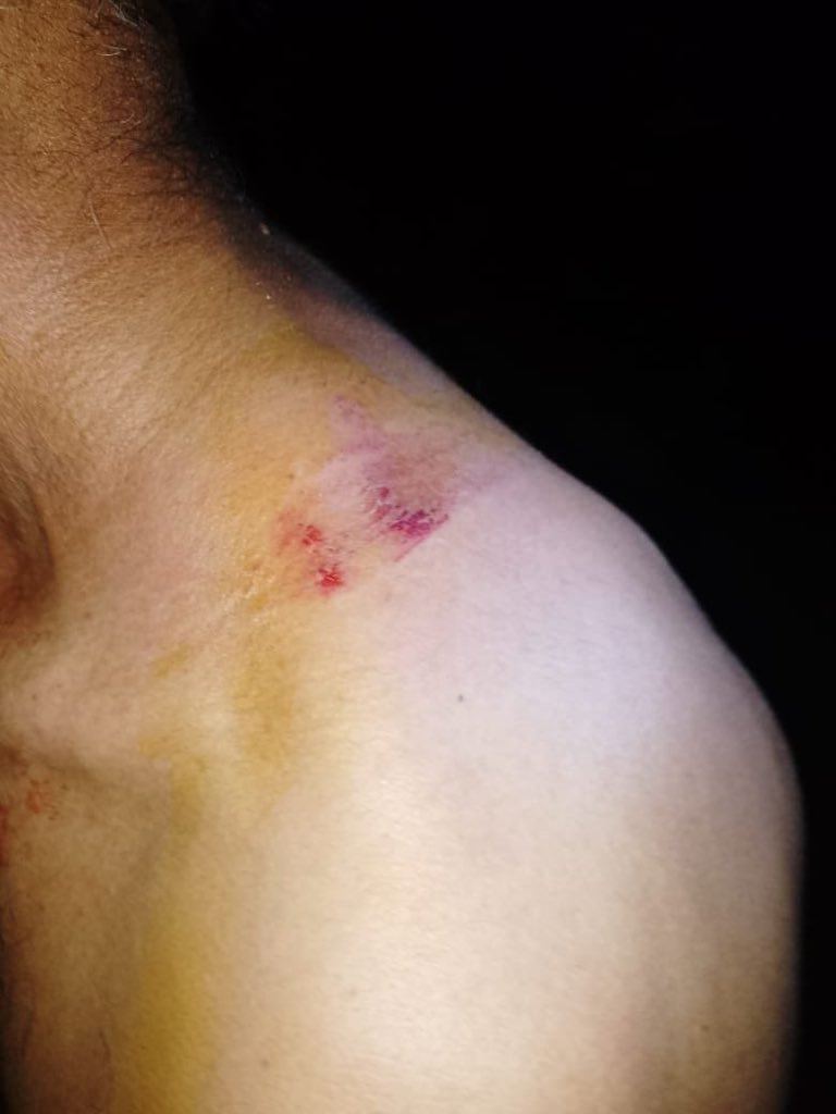 ملیر میں بلوچ گوٹھوں پر فورسز کا حملہ 77 سالہ بلوچ دشمن نوآبادیاتی پالیسیوں کا تسلسل ہے۔ کراچی کے بلوچوں نے جس بہادری سے بلوچ نسل کشی و جبری گمشدگیوں کے خلاف مزاحمت کی، اب ریاست انہیں تشدد کا نشانہ بنا کر انتقام لینا چاہتی ہے۔ اس طرح کی حرکتوں سے آوازوں کو خاموش کرنا ناممکن ہے