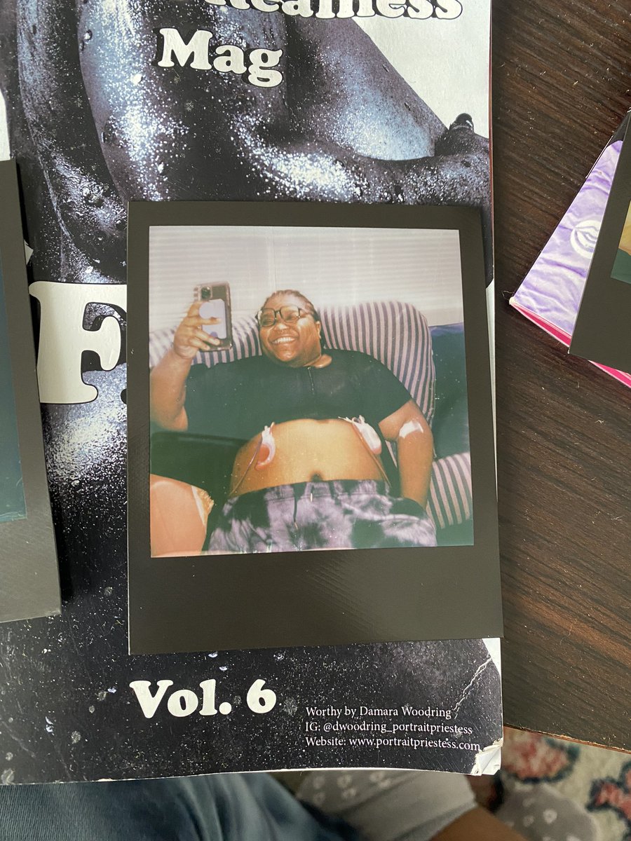 theythemsam's tweet photo. top surgery tings 🥰💙 https://t.co/cv0fHntGQ5