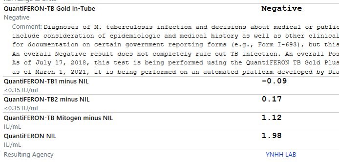 @BradSpellberg @TBrnaughtTB @LAGenHospMed @LAGeneral_ID Agree. To illustrate this, here is the report from someone who had fulminant Pulm TB at the time of this test. High ‘Nil’ levels suggesting high Interferons even before antigen stimulation. Question: why are these reported as “negative” instead of “invalid”.