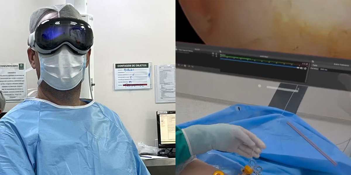 🚨🚨Apple Vision Pro used to assist doctor during shoulder arthroscopy surgery in Brazil.