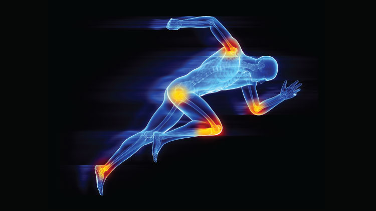 Key findings in sports medicine on topics such as rotator cuff repair, ACL reconstruction, and more are presented in the new JBJS Guest Editorial 'What’s New in Sports Medicine.' Read about the 5 most compelling studies on #OrthoBuzz: tinyurl.com/bdea9yhz