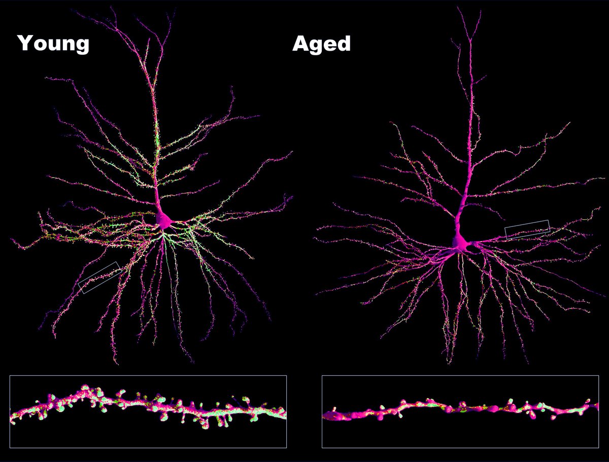 It's #FluorescentFriday! What happens in the brain during normal aging? While most neurons will not shrink, they will lose synapses, the connections between different neurons, which can affect learning and memory. But how do we take these images from primates? (1/5)