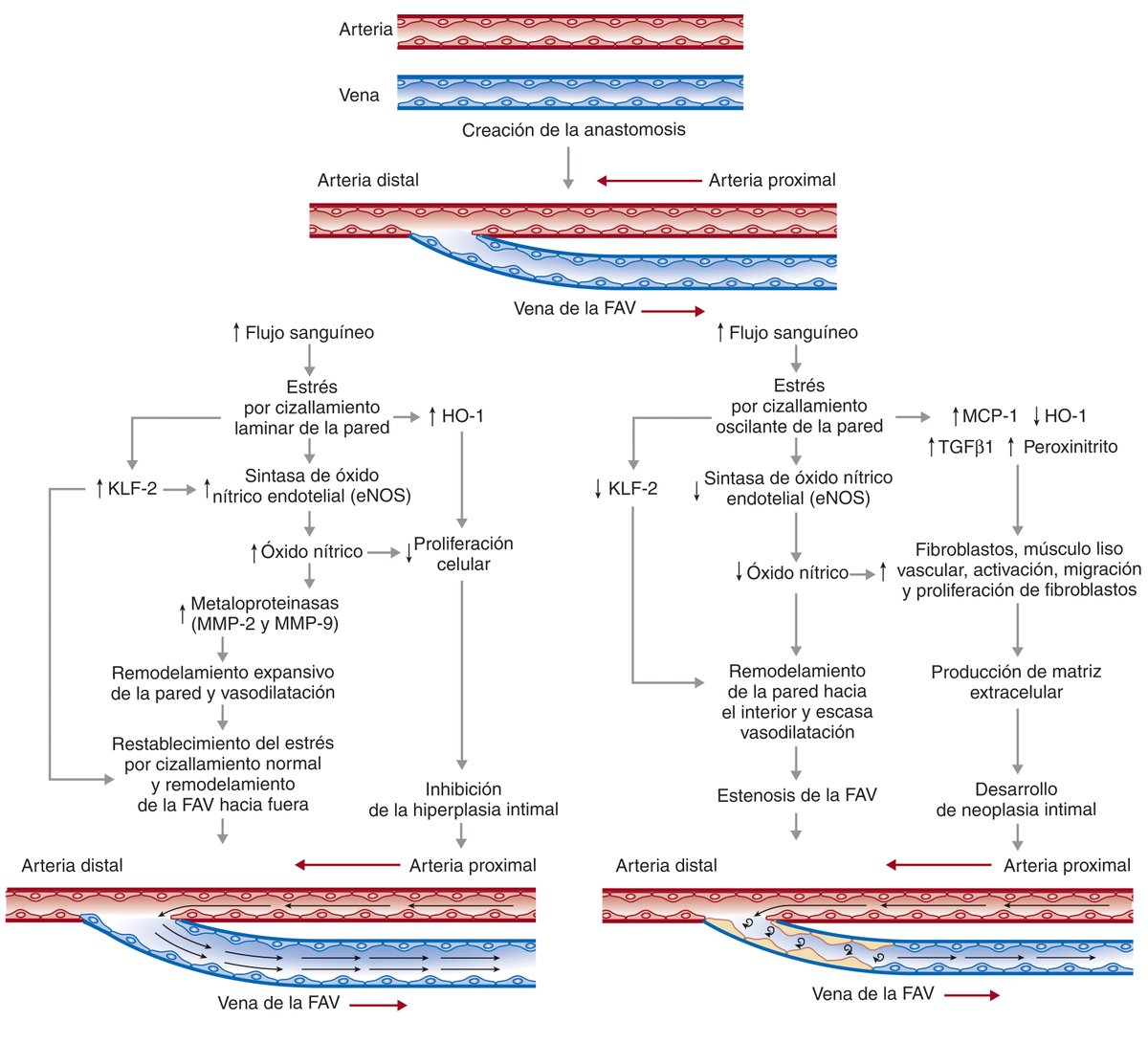 Eventos fisiopatológicos de la maduración satisfactoria y del fallo de maduración de una FAV

#Interventionalnephrology #NefrologíaInvertencionista #Hemodialysis #HD #FAV #AVF