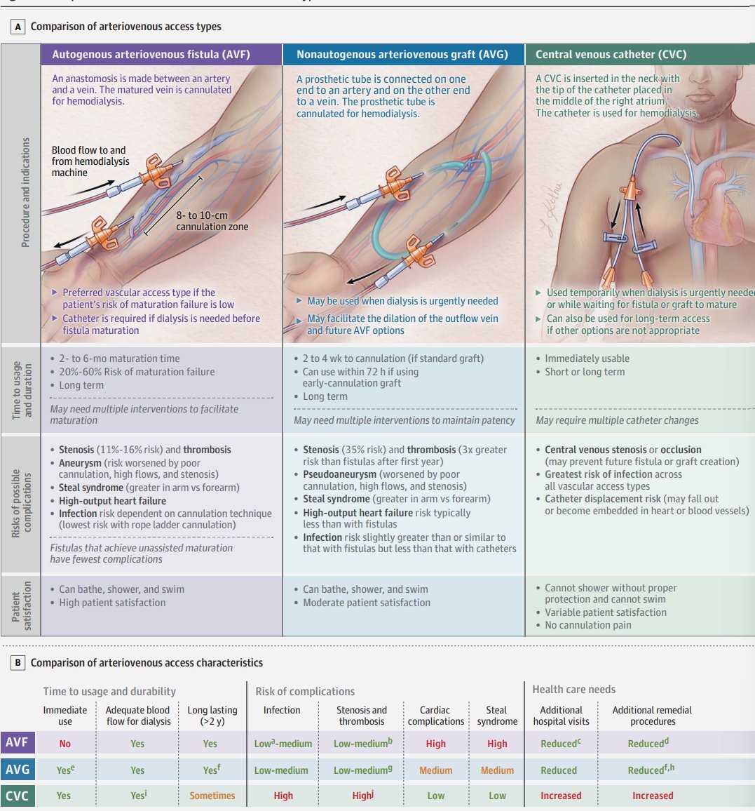 NefroClassMx's tweet photo. A) Comparación de tipos de acceso AV

B) Comparación de las características del acceso AV

doi:10.1001/jama.2024.0535 https://t.co/Oi7tQKbv3u