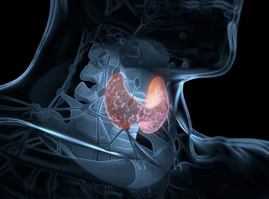 DNA- and RNA-based next-generation sequencing is the most crucial aspect in determining the right treatment option when assessing patients with thyroid cancer, according to @LovaSunMD @PennMedicine. #THYCSM targetedonc.com/view/understan…