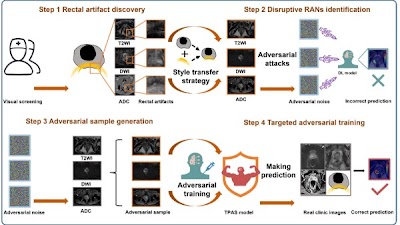 Radiology_AI's tweet photo. #TPAS model can reduce rectal artifact interference in MRI-based #PCa diagnosis https://t.co/sPybQEQfqB @BiocLnkgnEcwEfT #prostate #AbdRad #DeepLearning https://t.co/scmd88qzPa