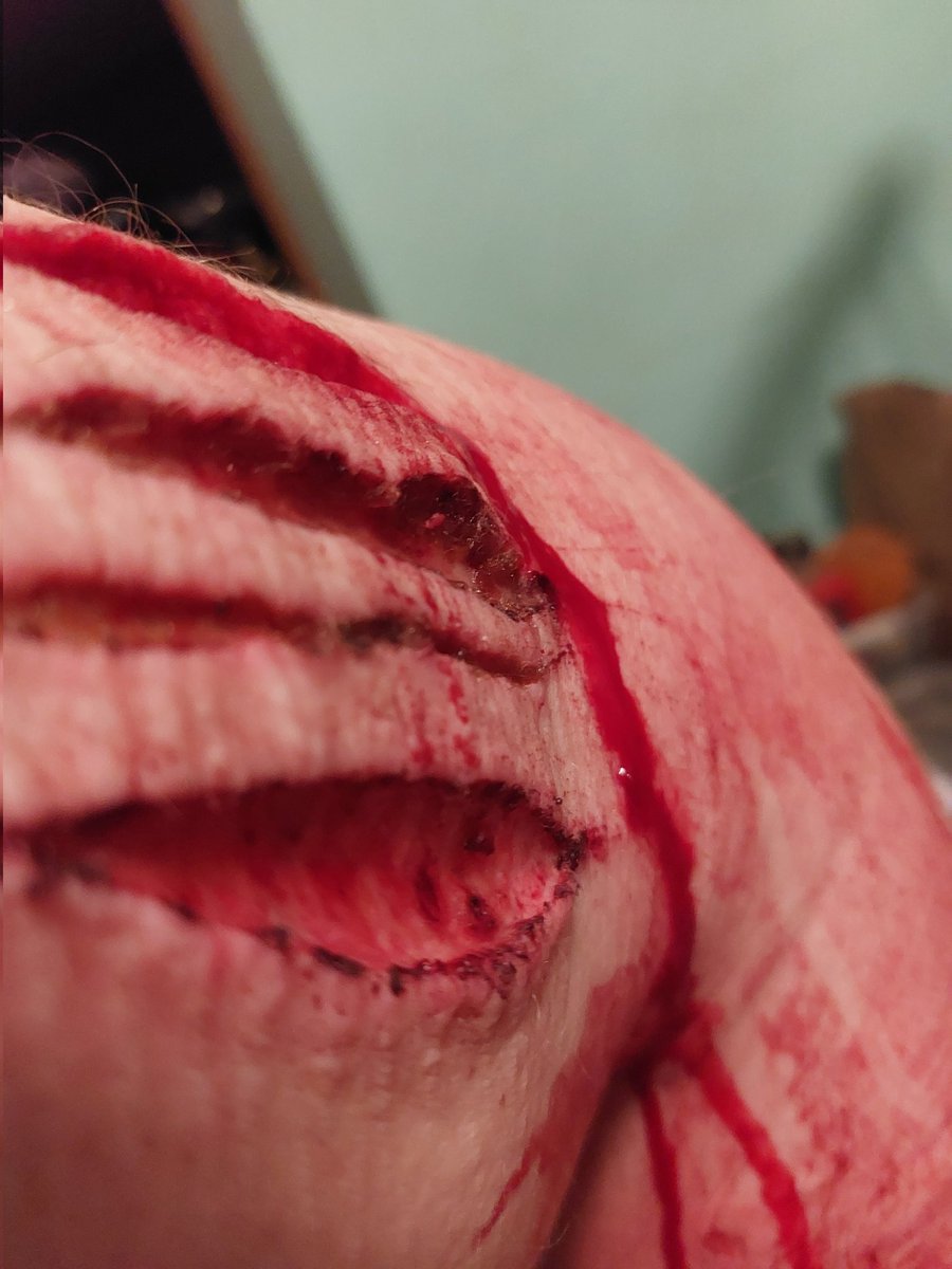 SPAM29633408's tweet photo. SFX MAKE UP MAKEUP, FAKE FAKE FAKEROONI
.
Bear attack🙀 grrr🐻
.
#shtwt #988twt #sliceytwt #ouchietwt #kmstwt #g0retwt #yellowspongetwt #beanstwt https://t.co/VaD12uDihV