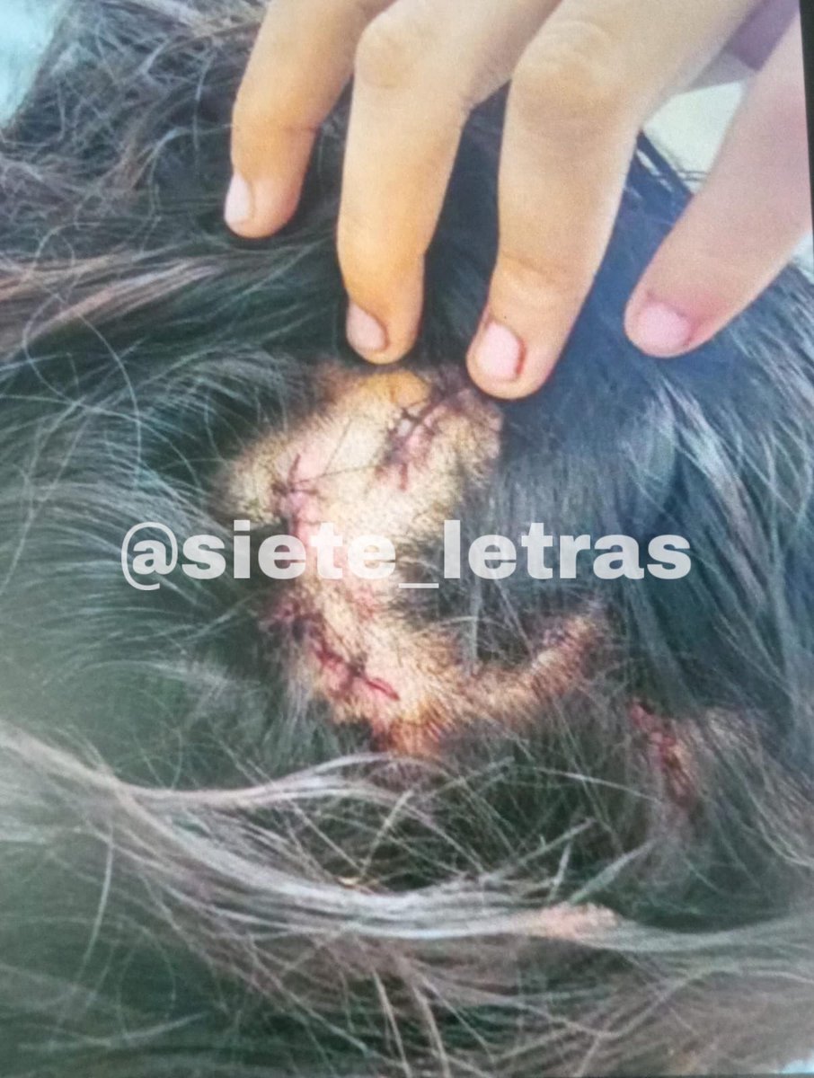 siete_letras's tweet image. Este es Rodrigo, tiene 13 años y golpeó y acuchilló 15 veces a su ex novia, Alondra:

Todo porque no quiso regresar con él. La atacó afuera del Liceo Emperadores Aztecas, @Alc_Iztapalapa. 

Rodrigo está detenido y es hijo de un jugador de voleibol seleccionado. Se dice “impune”.