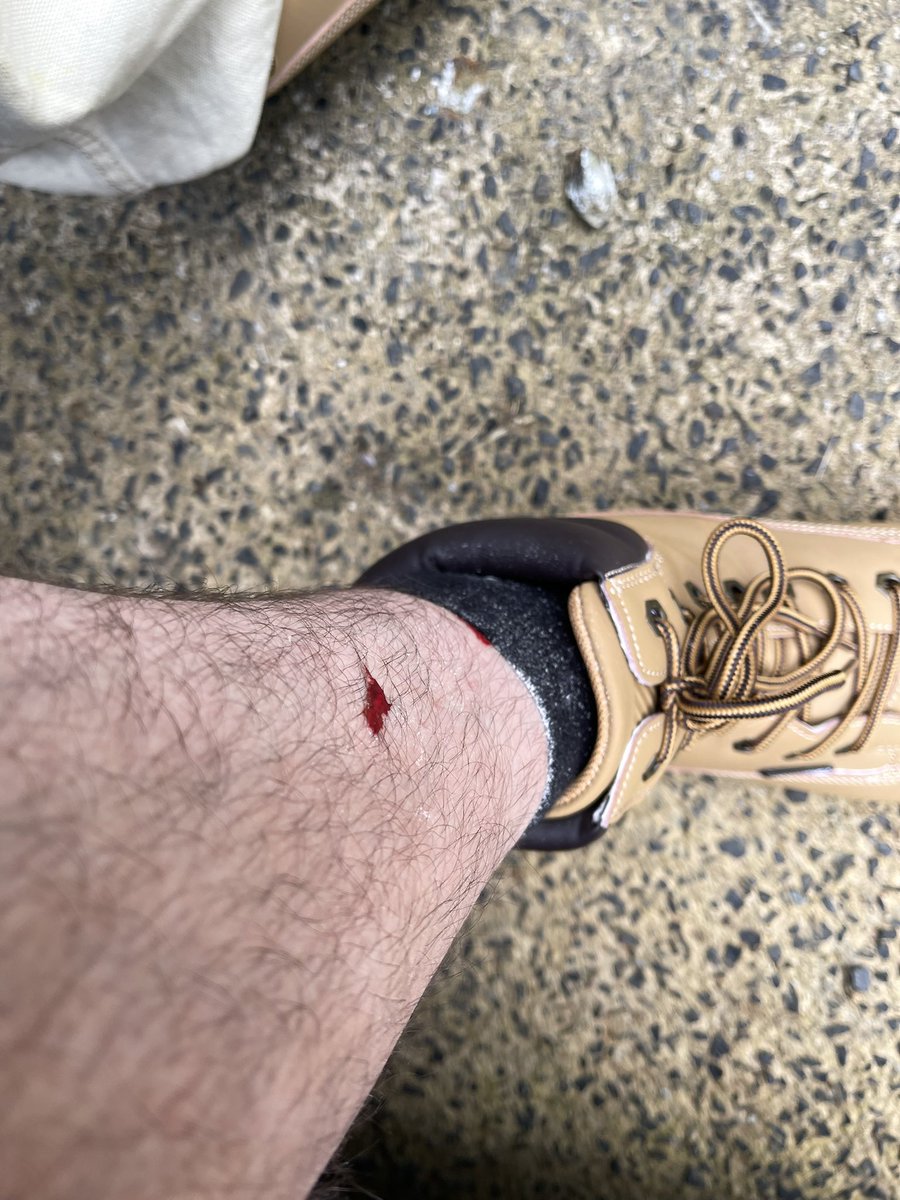 SidequestChaser's tweet photo. got sucked off by leeches for the first time https://t.co/8GeoATl6eX