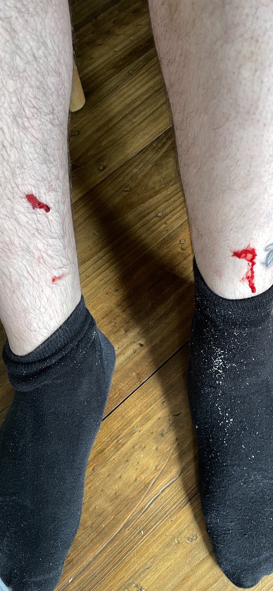 SidequestChaser's tweet photo. got sucked off by leeches for the first time https://t.co/8GeoATl6eX