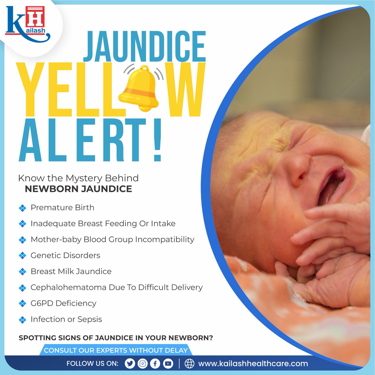 👶Welcoming a new bundle of joy into the world is an incredible experience, but it's important to be aware of common conditions like jaundice. 💛Jaundice occurs when a baby's liver is still developing and struggles to process bilirubin effectively. Rest assured, most cases of