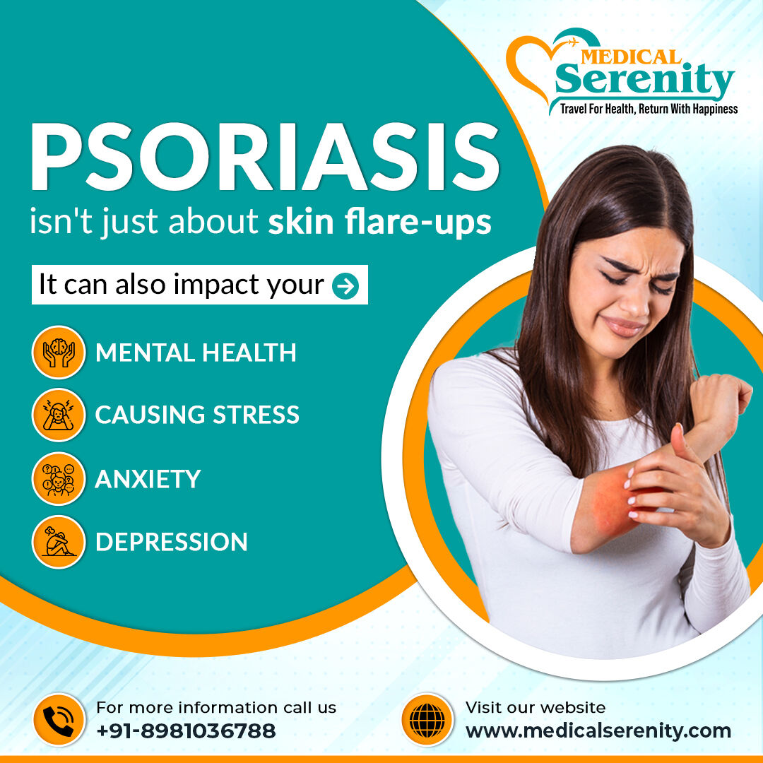 Living with psoriasis means battling more than just skin flare-ups. Take control of your skin health with our comprehensive treatment options. Call now 📞 to learn more. 🩺

#medicalserenity #psoriasis #skinhealth #treatment #services #wellnesstourism