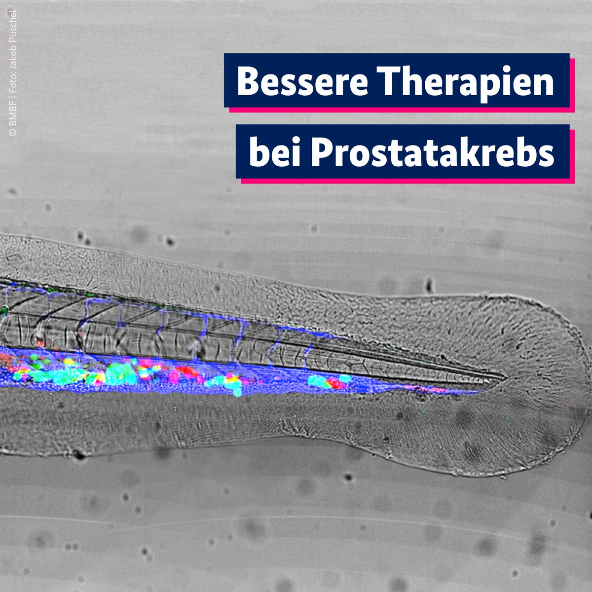 Hoffnung auf gezieltere Therapien bei #Prostatakrebs: Dresdner Forschende haben zwei Gene entdeckt, die für Wachstum und Metastasierung verantwortlich sind. #OncoRay @HZDR_Dresden @IelizavetaGoro2 #XgegenKrebs 👉 dekade-gegen-krebs.de/de/krebsforsch…