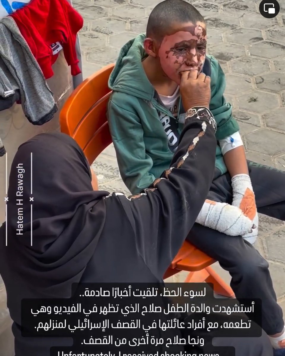 The boy Salah's mother, who is seen feeding him in the video, has been killed along with several family members during an Israeli bombing of their home in Gaza. Salah survived the bombing once again. Source: Journalist Hatem Hany from Gaza (hatem.h.rawagh on Instagram)