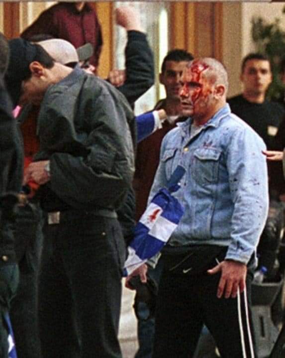 20.04.2002, Θεσσαλονίκη, πλατεία Αριστοτέλους

Χρυσαυγιτης με ανοιγμένο κεφάλι μετά από συμπλοκή με αναρχικούς κ αντιεξουσιαστες