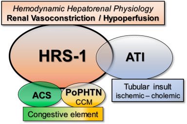 Pathophysiology of Hepatorenal Syndrome sciencedirect.com/science/articl… @NephRodby @Nhepatic @akdhjournal @HrsHarmony #HRS @serenellaavelez