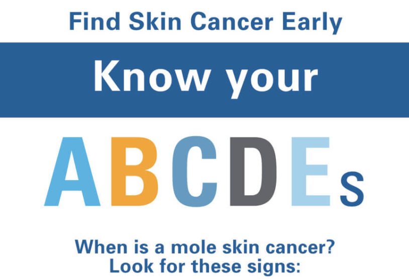 Atypical moles are irregular moles that can appear anywhere on the body. To spot atypical moles or something more serious, learn your ABCDEs. ms.spr.ly/6017Y6vfL
