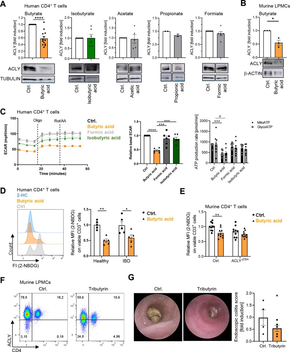 #GUTImage from the paper by Schulz-Kuhnt et al entitled

'ATP citrate lyase (ACLY)-dependent immunometabolism in mucosal T cells drives experimental colitis in vivo' via

bit.ly/3vf2hzY

#Colitis