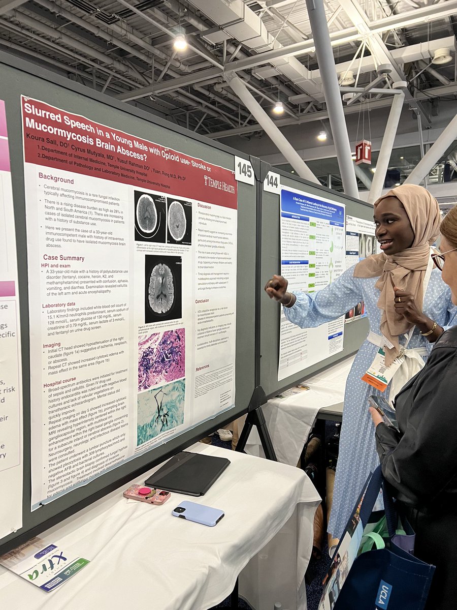 Had so much fun presenting a unique case of isolated cerebral mucor abscess in an IVDU patient at the #ACPabstractcompetition! Thank you for the engagement @ACPIMPhysicians ! #IM2024 #Abstractcompetion #ACP2024