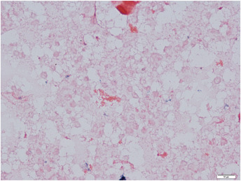 The first human case report of molecularly confirmed co-infection of Brucella melitensis and Coxiella burnetii: A case report dlvr.it/T5mfRt