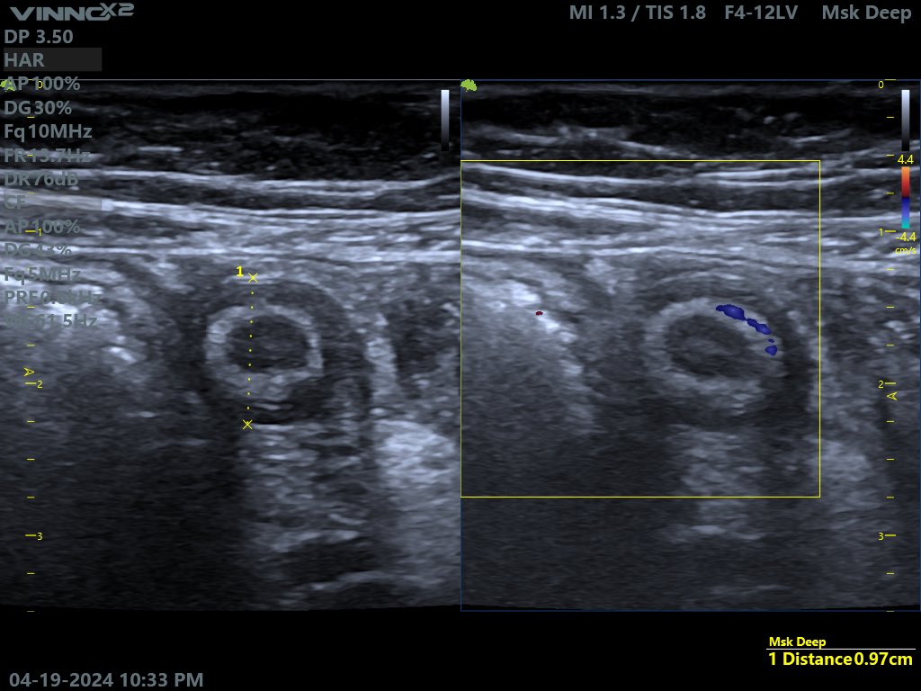 EchoTech_4 tweet picture