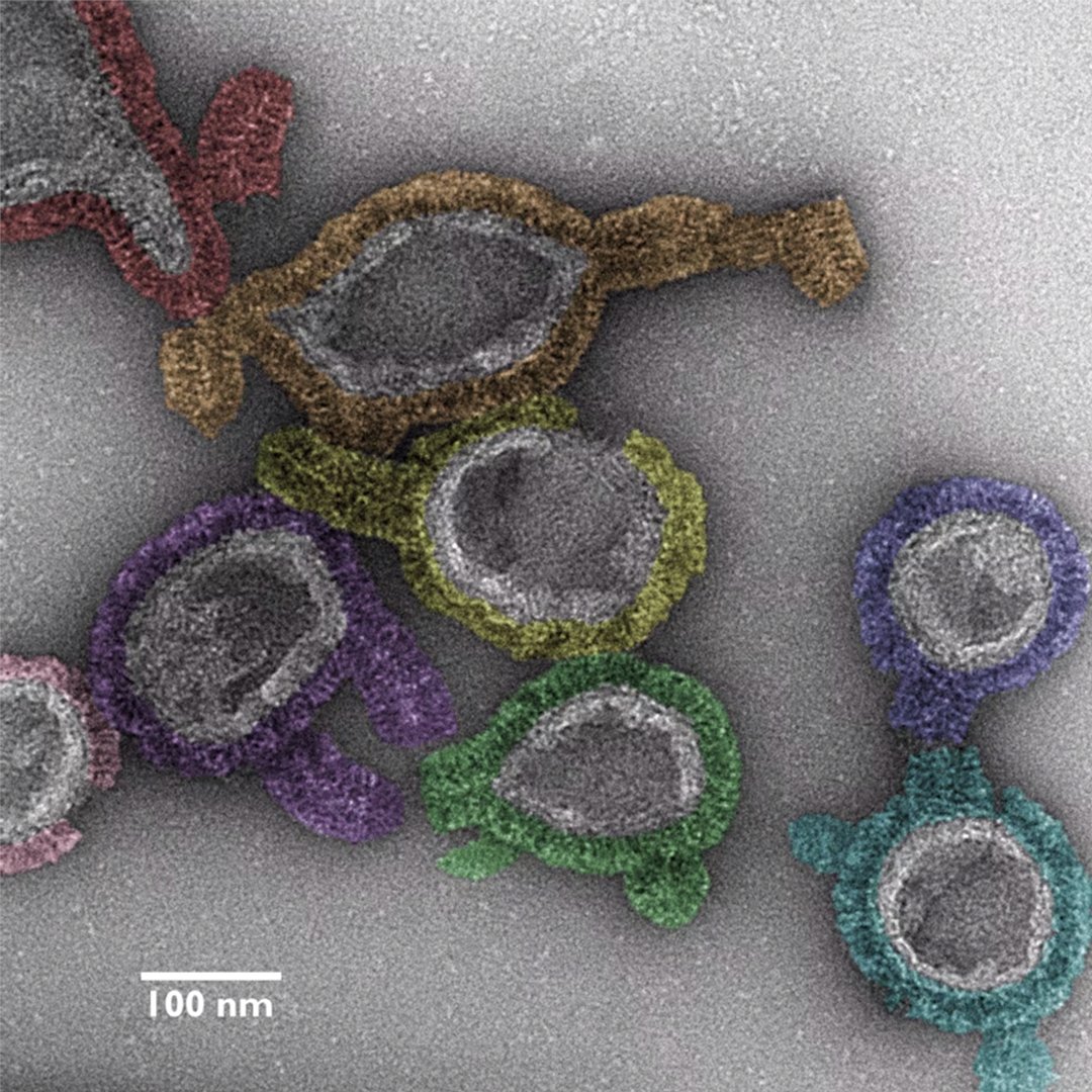 Another fascinating picture submission in the @helmholtz_image 'Best Scientific Image Contest' comes from #mdcBerlin researcher Marius Weismehl (Daumke Lab). It shows protein polymers targeting artificial vesicles. Like what you see? Vote now (ID 288)! 👉 awards.helmholtz-imaging.de/entry/vote/Ryw…