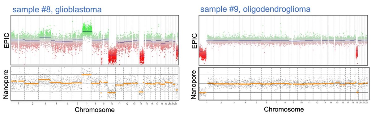 Always thought #Nanopore sequencing from #FFPE is impossible? Explore our paper: tinyurl.com/ffpe-nanopore. Methylation & CNV profiling of CNS tumors. Great collaboration with @ulrichschueller and @LschweizerLeo. @nanopore