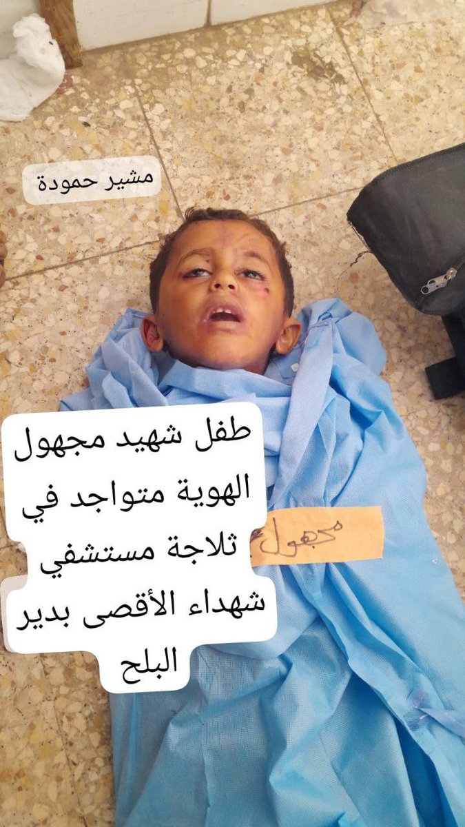 An unidentified child martyr in Al-Aqsa Martyrs Hospital in Deir Al-Balah in the central #Gaza Strip

#IsraelWarCrimes #IsraelWarCriminal #IsraelCrimes #IsraelCrimesagainstHumanity #PalestinianLivesMatter