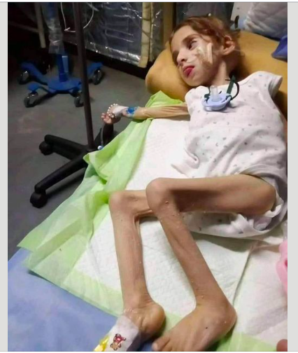 This is the face of Gaza. This is the policy of deliberate starvation of an entire people. This is a war crime.